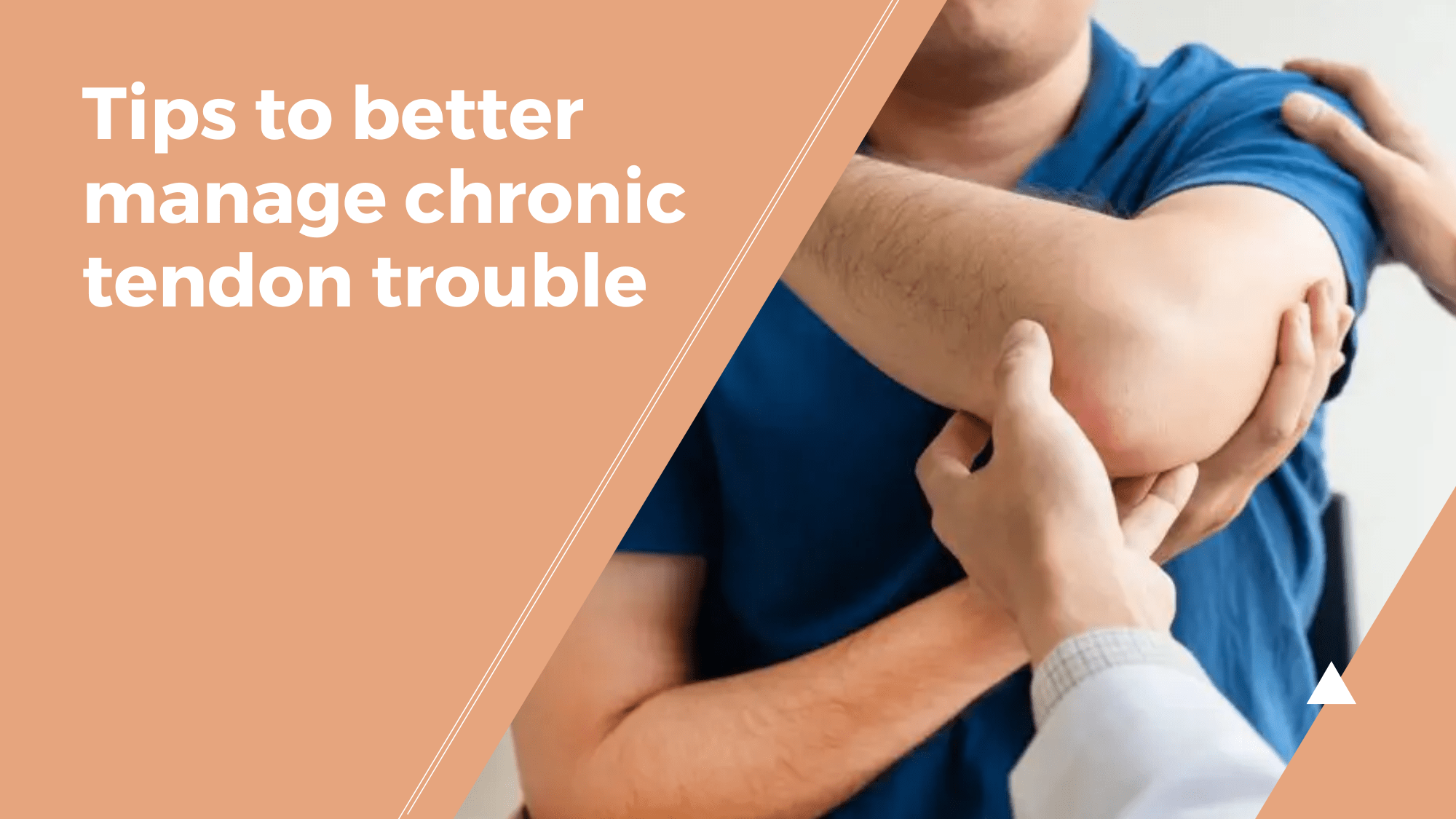 Tips to better manage chronic tendon trouble